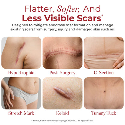 HealFast Anti-Scar Sheeting: Tape